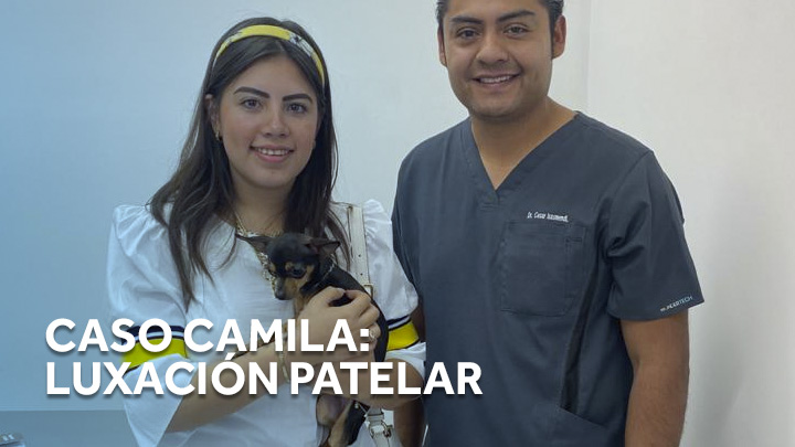 Camila: Luxación Patelar